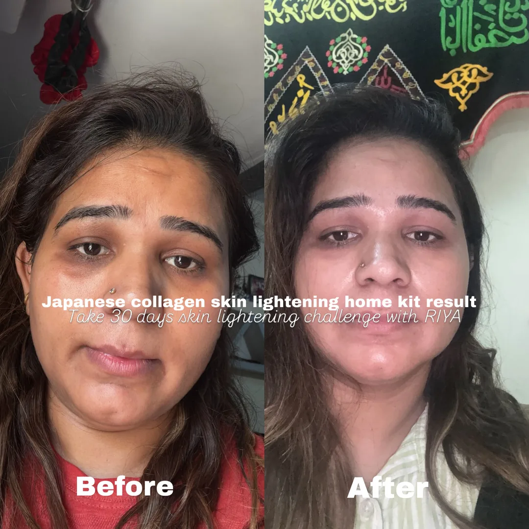 Skin tone & brightness — before and after