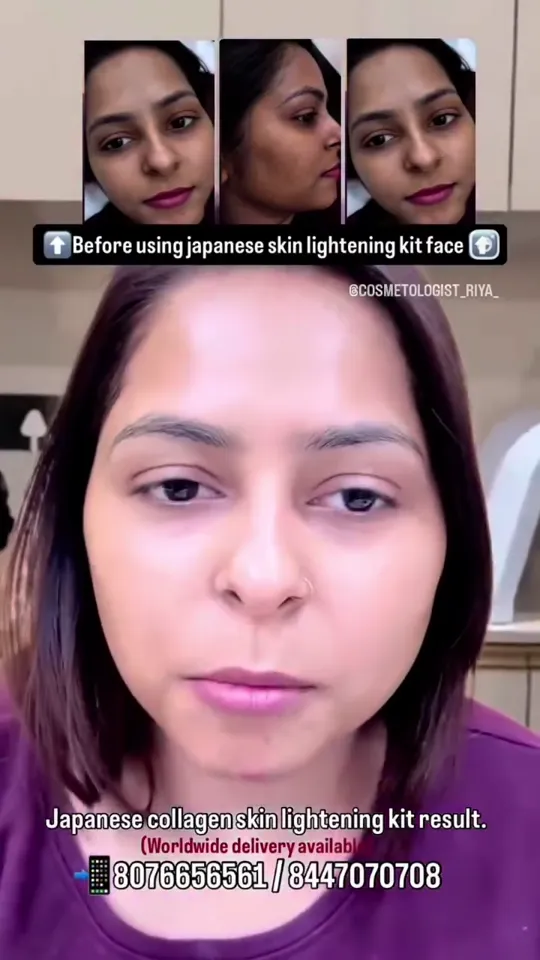 Skin lightening kit result